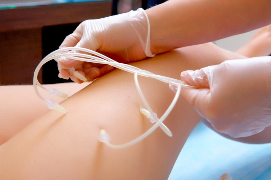 Озонотерапия в санатории